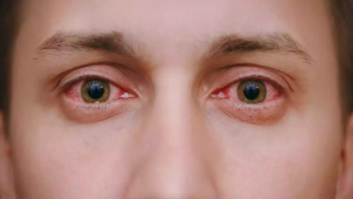 Photo of उत्तराखंड में तेजी से फैल रहा आई फ्लू,एक्सपर्ट से जानिए लक्षण और बचाव!