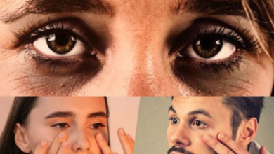 Photo of क्या आप भी आंखों पर पड़े Dark Circles से परेशान हैं? तो करे ये बेहतरीन घरेलु उपाय…