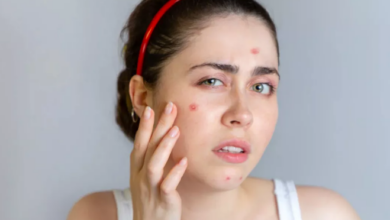 Photo of पिंपल्स तो दूर करेंगे ही साथ ही चेहरे की चमक भी बढ़ाते हैं ये होममेड फेस पैक्स…