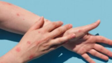 Photo of उत्तराखंड: मंकी पॉक्स को लेकर अलर्ट, स्वास्थ्य विभाग ने दिए एहतियात बरतने के निर्देश