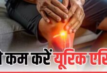 Photo of High Uric Acid के लेवल को कम कर देते हैं ये फूड्स