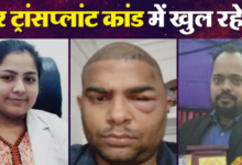 Photo of दांतों की डॉक्टर ने 40 हजार में किए थे हेयर ट्रांसप्लांट… ये काम करने का किया था दावा; एक और नया खुलासा