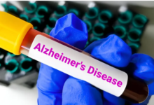 Photo of लक्षण दिखने से 10 साल पहले ही पता चल सकेगा अल्जाइमर का खतरा