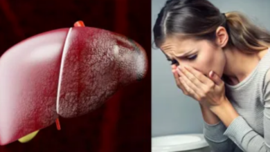 Photo of त्वचा पर नजर आते हैं लिवर की खराबी के 5 लक्षण