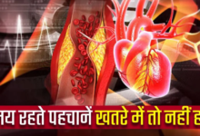 Photo of डायबिटीज के मरीज ध्यान दें: रूटीन चेकअप में शामिल करें यह एक टेस्ट