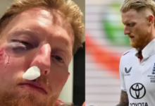 Photo of इंग्लैंड के कप्तान बेन स्टोक्स के चेहरे पर लगी भयानक चोट