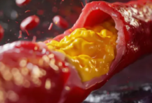 Photo of क्या बिना किसी लक्षण के शरीर में बढ़ सकता है कोलेस्ट्रॉल?