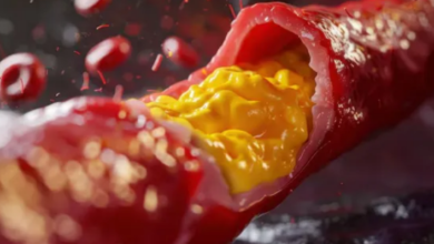 Photo of क्या बिना किसी लक्षण के शरीर में बढ़ सकता है कोलेस्ट्रॉल? 